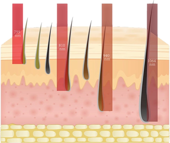 ความปลอดภัยของเครื่อง Diode Laser