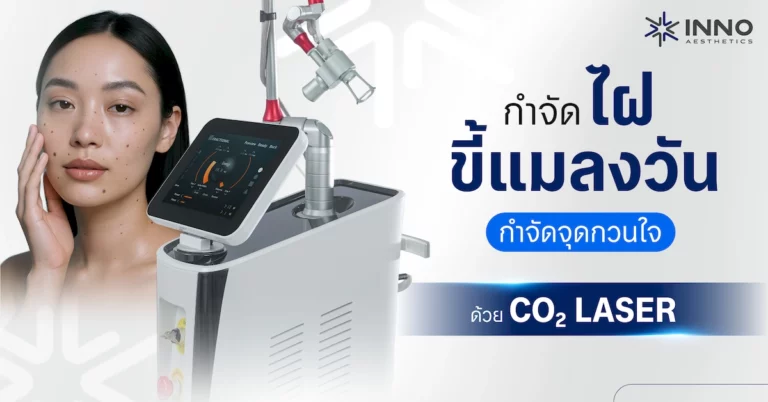 กำจัดไฝ ขี้แมลงวัน กำจัดจุดกวนใจ ด้วย Co2 laser