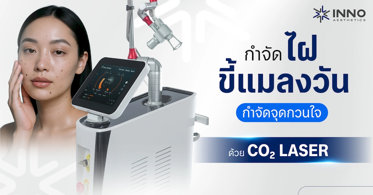 กำจัดไฝ ขี้แมลงวัน กำจัดจุดกวนใจ ด้วย Co2 laser