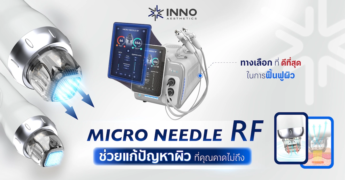 Micro Needle RF ช่วยแก้ปัญหาผิวที่คุณคาดไม่ถึง