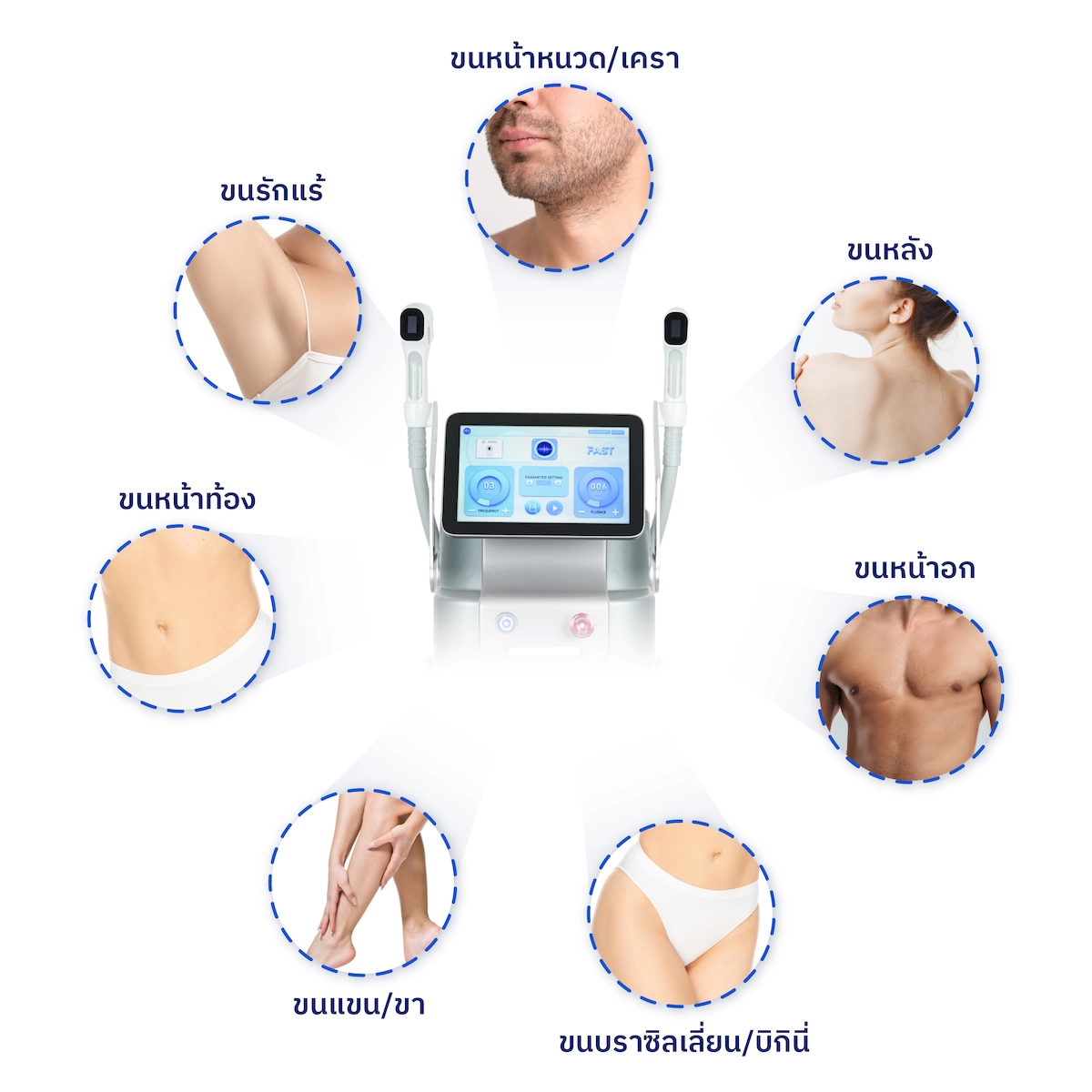 Treatment Site for DIORA DUAL-PRO