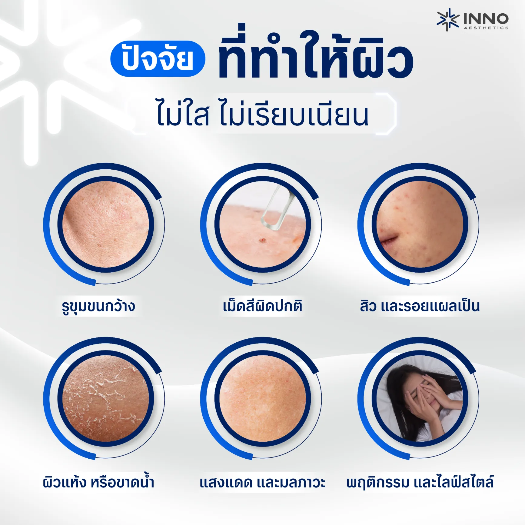 ปัจจัยที่ทำให้ผิวไม่ใส ไม่เรียบเนียน