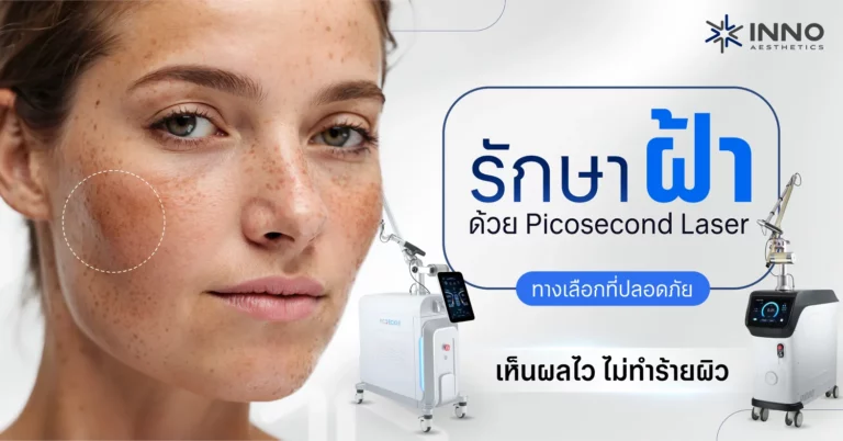 รักษาฝ้าด้วย Picosecond Laser ทางเลือกที่ปลอดภัย เห็นผลไว ไม่ทำร้ายผิว