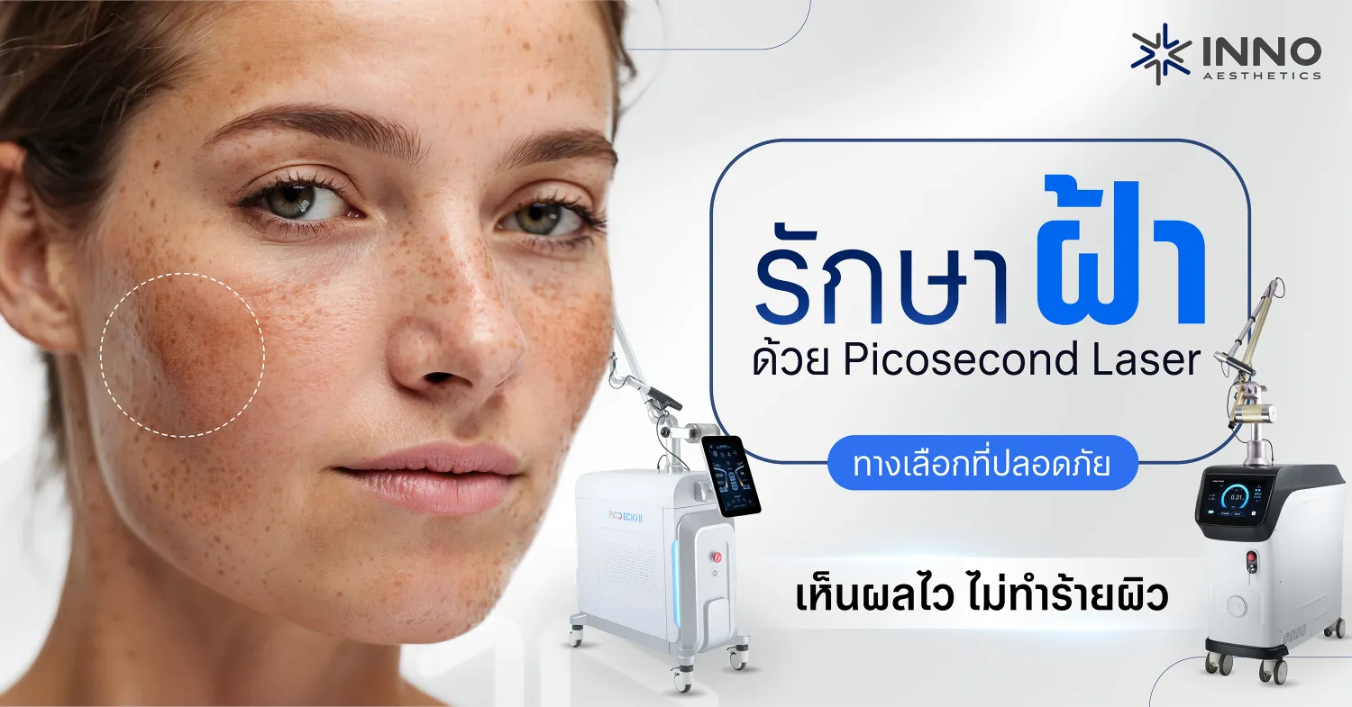 รักษาฝ้าด้วย Picosecond Laser ทางเลือกที่ปลอดภัย เห็นผลไว ไม่ทำร้ายผิว