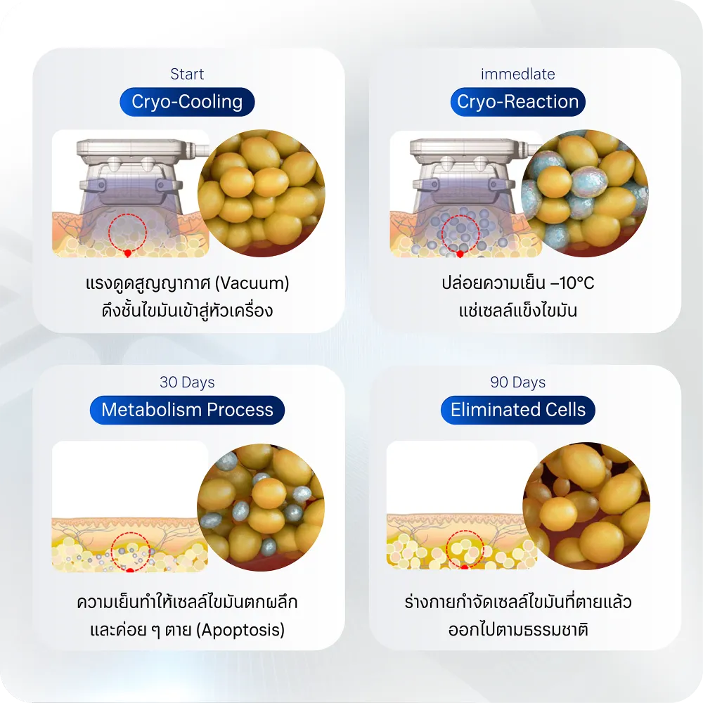 กระบวนการของเครื่องสลายไขมัน