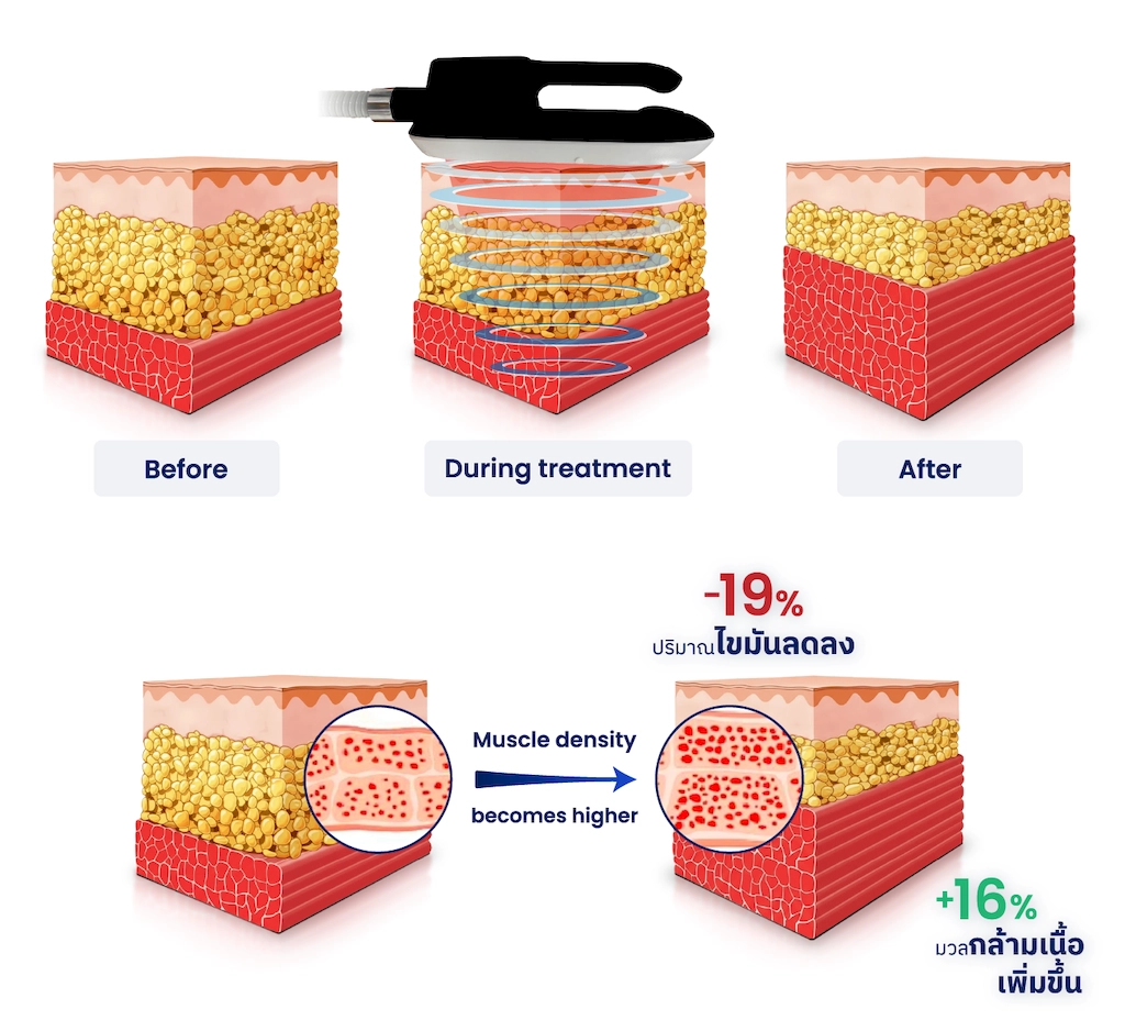 เจาะลึกหลักการทำงาน Maximus Pro