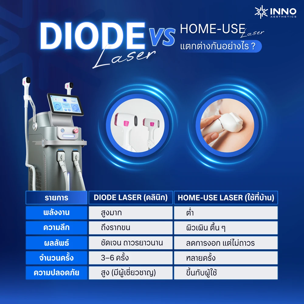 เลเซอร์ขน Diode Laser และ Home-Use Laser แตกต่างกันอย่างไร