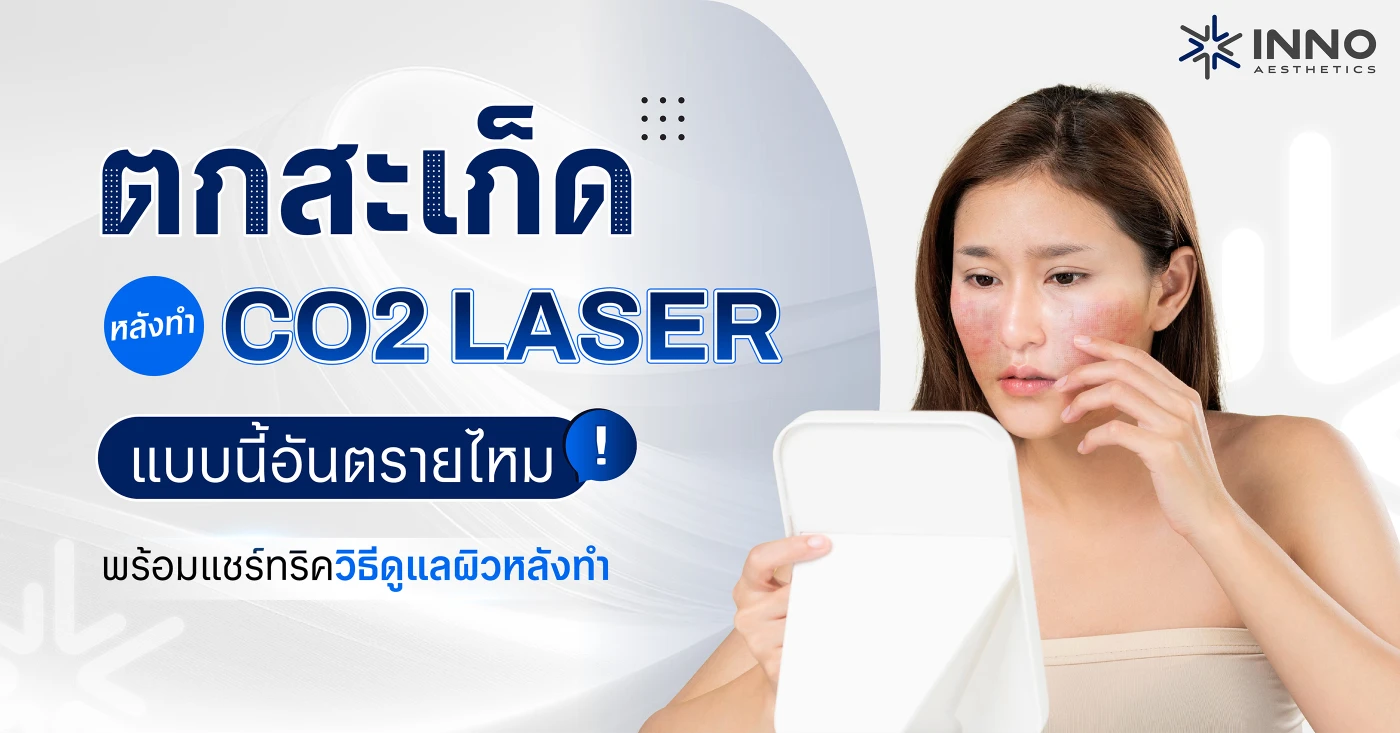 ตกสะเก็ดหลังทำ CO2 Laser แบบนี้อันตรายไหม ทริควิธีดูแลผิวหลังทำ