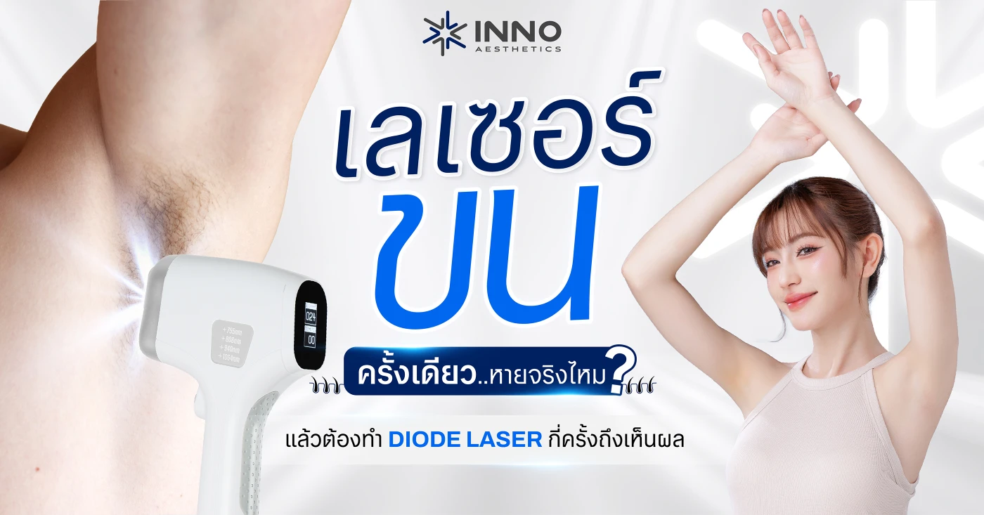 เลเซอร์ขนครั้งเดียวหายจริงไหม? แล้วต้องทำ Diode Laser กี่ครั้งถึงเห็นผล