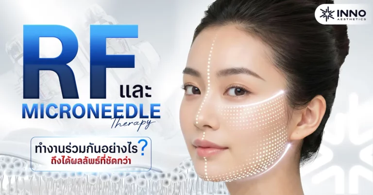 RF และ Microneedle Therapy ทำงานร่วมกันอย่างไร ให้ผลลัพธ์ชัดกว่า