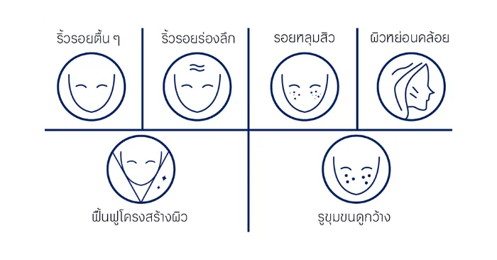 โปรแกรม “Reskin Pinxel” หนึ่งเครื่อง สร้างได้กี่โปรแกรม