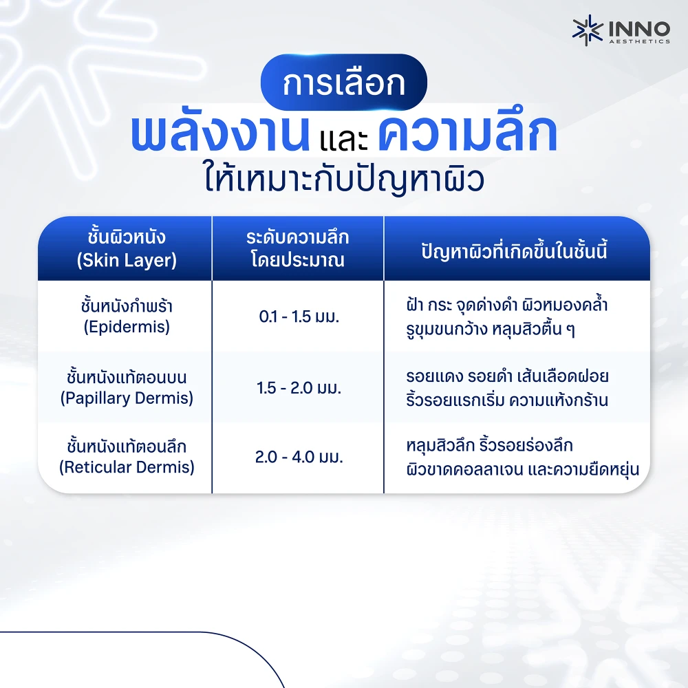 การเลือกพลังงาน และความลึกให้เหมาะกับปัญหาผิว