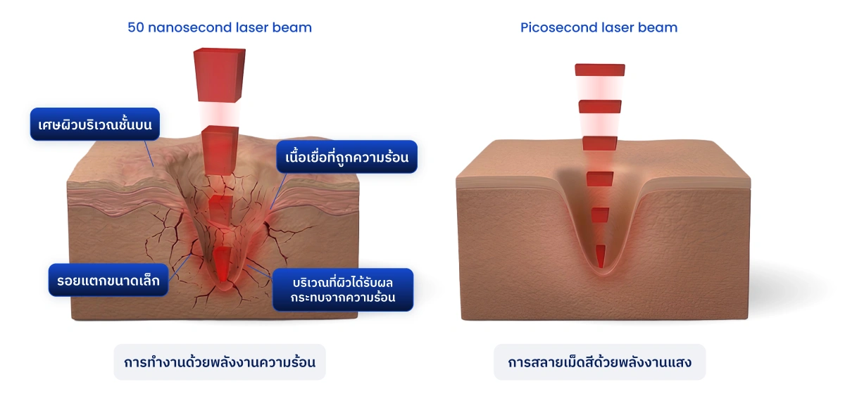 50 nanosecond laser beam and picosecond laser beam