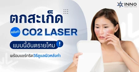 ตกสะเก็ดหลังทำ CO2 Laser แบบนี้อันตรายไหม ทริควิธีดูแลผิวหลังทำ