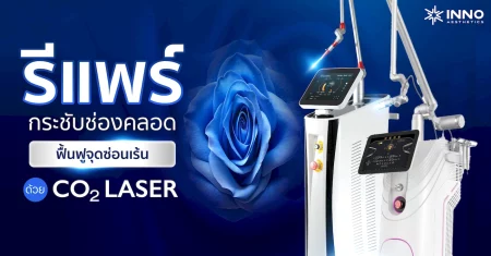รีแพร์ กระชับช่องคลอด ฟื้นฟูจุดซ่อนเร้น ด้วย Co2 Laser