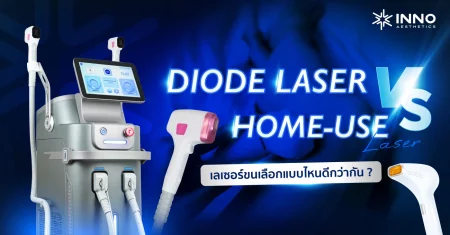 Diode Laser vs Home-Use Laser เลเซอร์ขนเลือกแบบไหนดีกว่ากัน?