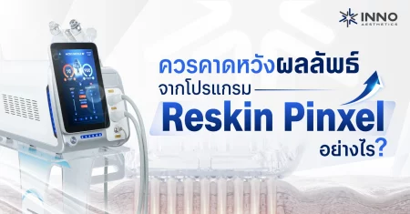 ควรคาดหวังผลลัพธ์จากโปรแกรม Reskin Pinxel อย่างไร