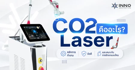 CO2 Laser คืออะไร? หลักการทำงาน ข้อดี เหมาะกับการรักษาแบบไหน
